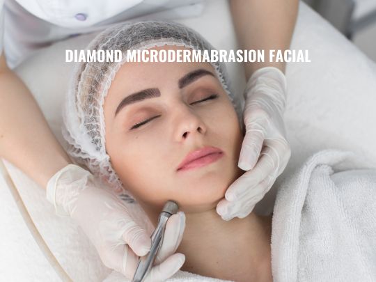 Diamond Microdermabrasion Facial in Toronto